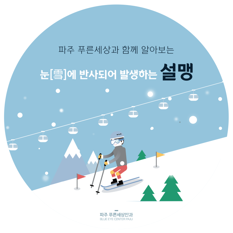겨울철 발생하는 안구질환인 설맹, 어떻게 예방해야 할까?