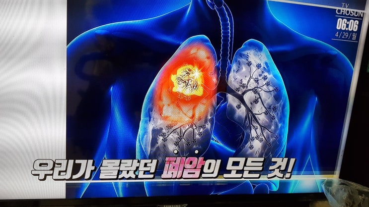 윤문식씨 폐암 극복 물냉이 카카두플럼