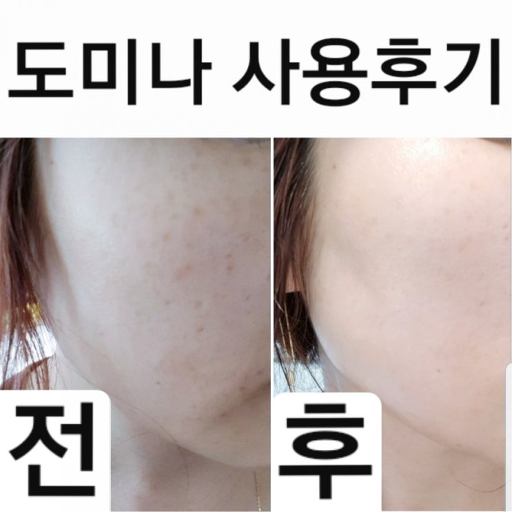 (체험단 X)도미나크림 후기, 가격, 사용법, 2달 사용효과, 부작용(후유증), 약국에서 내돈 주고 산 태극제약 도미나크림 or TG 티지 도미나스크림, 기미 주근깨 잡티 화장품