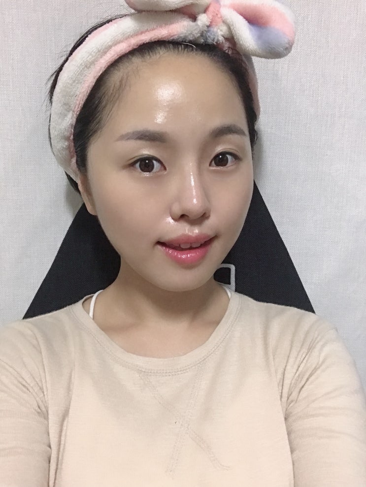 목동물광관리 뷰스킨앤바디 송지효물톡스 최고 !