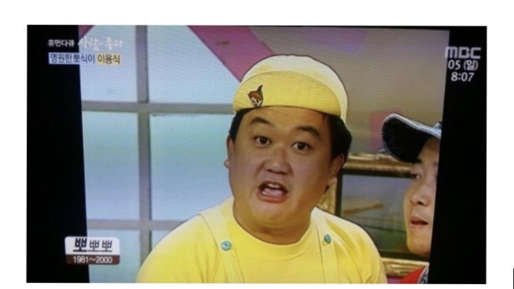 이용식나이 한쪽눈실명 남진 무슨사이?