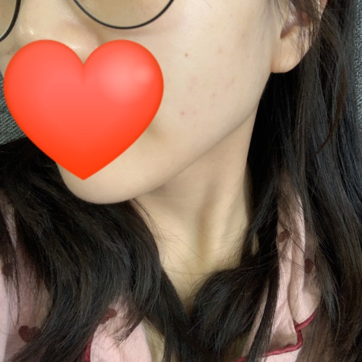 건성피부의 갑작스러운 뾰루지 파티, 홈케어로 되돌리기 프로젝트~~!(4개월 뒤)BRTC 골드 판테놀 리바이탈 슬리핑팩/ 에뛰드 하우스 순장 수분 베리어 크림/해면 스판지 세안