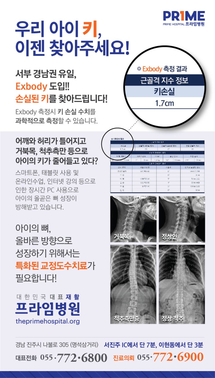 프라임병원 - 경남 진주 재활병원 - Exbody측정 - 키손실