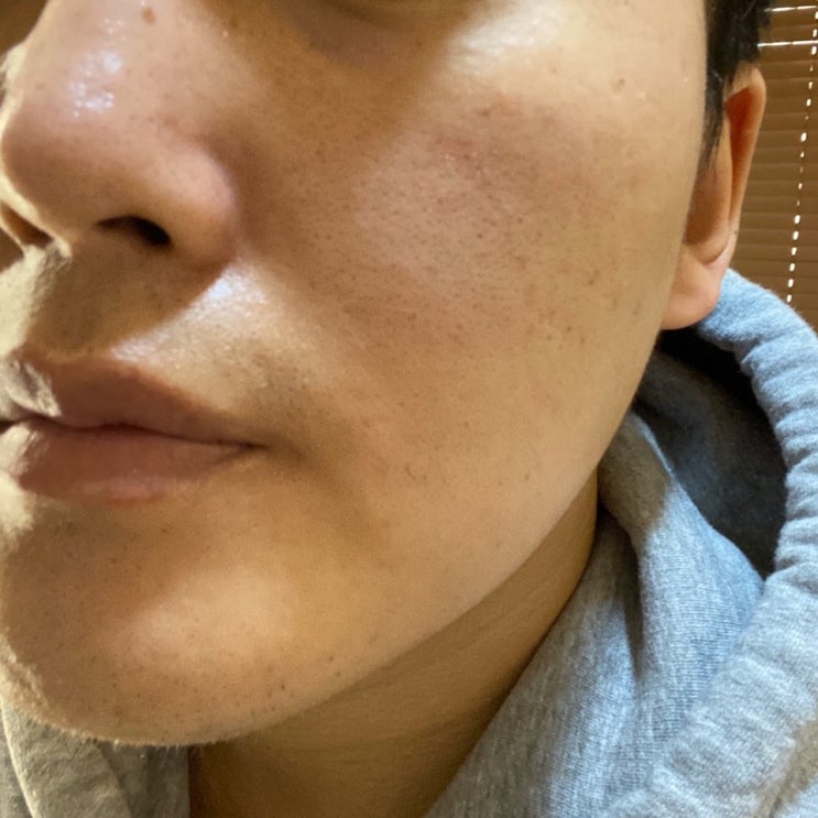 [경기/고양] 장항동 피부관리 잘하는집 