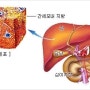 지방간(fatty liver)