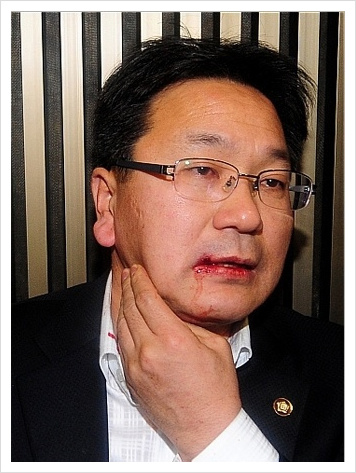 김성회 국회의원