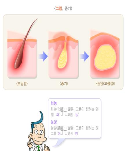 종기 : 네이버 블로그