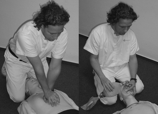 Overhead chest compression ( Straddle external chest compression ...