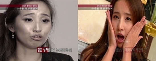 ' 에로배우 ' 최은 양악수술 후 첫 방송출연 : 네이버 블로그