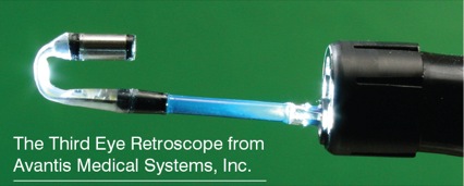 Avantis medical systems 의 Third eye retroscope : 네이버 블로그
