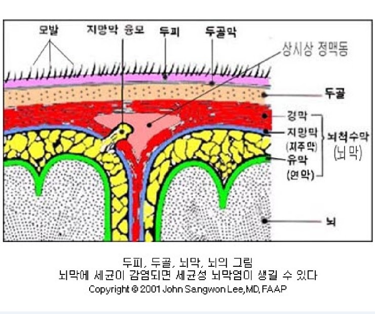 뇌질환과 신경질환 및 채매 : 네이버 블로그