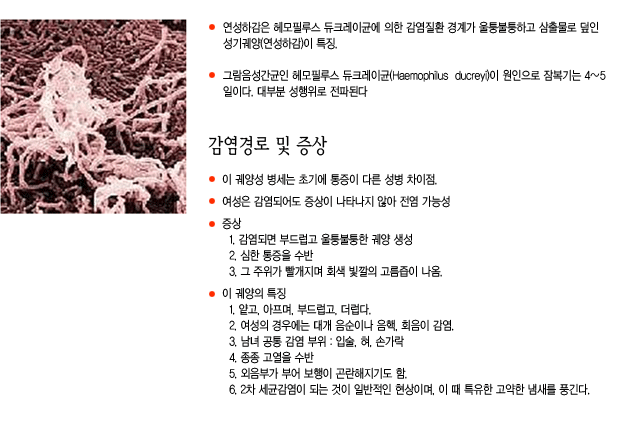 헤모필루스 듀크레이 궤양