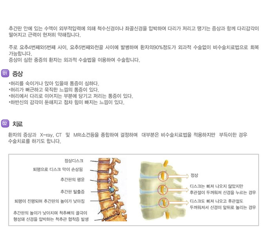 추간판 탈출증 (디스크) [일산,행신,고주파열치료] : 네이버 블로그
