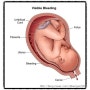 쌍둥이 태아 실손의료비 손해보험 가입하는 방법