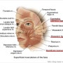 양악수술,안면윤곽 수술 후 피부처짐 교정 : 스마트리포 TPX+울쎄라