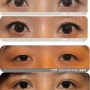Method of double eyelid surgery--Understanding Asian double eyelid(3)