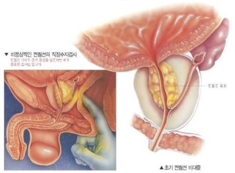 2ch 펌> 위험한 자위 혹은 암자위 : 네이버 블로그, image size:480x353