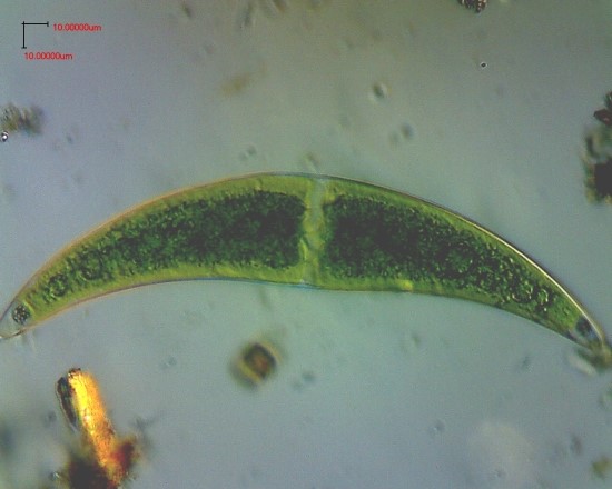 클로스트리움./Closterium acerosum-POLYVAR Microscope : 네이버 블로그