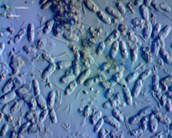 유산균음료속의 효모와 유산균 사진입니다/POLYVAR Microscope로 촬영. : 네이버 블로그