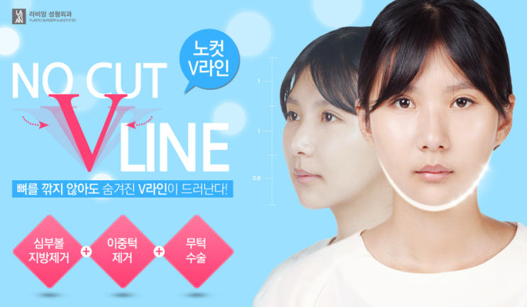 라비앙성형외과 노컷V라인 : 네이버 블로그