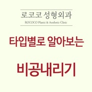 타입별로 알아보는 비공내리기 이야기 목차