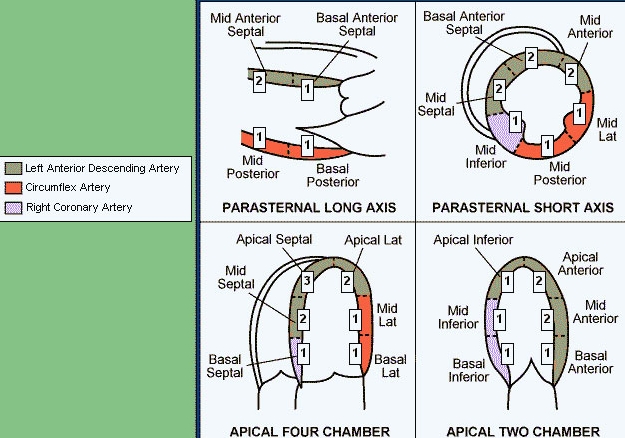 Wall Motion Abnormality