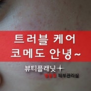 문래동 피부관리실 ♥ 뷰티플래닛 // 영등포 여드름 관리 잘하는곳 추천