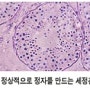 남성불임진단 - 남성불임검사
