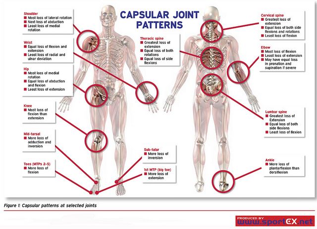 관절낭양상 (capsular pattern) : 네이버 블로그