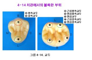 [치아형태학] 치아, 치관에서 볼록한 부위 : 네이버 블로그
