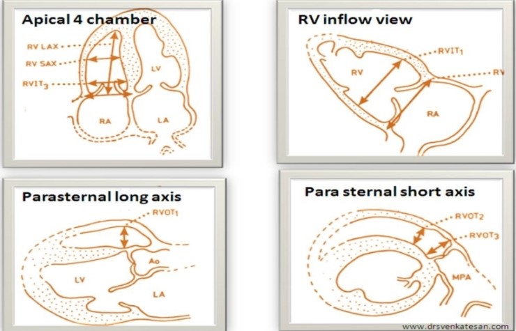 RV (2) : RV measurement : 네이버 블로그