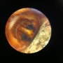 달팽이비탈가게거미alloclubionoides cochlea
