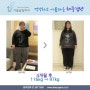 위밴드수술 4개월 후 19kg 감량 전후사진