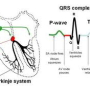 Cardiac conduction system on ECG (심전도 _ 심장신호전달계)