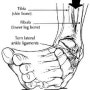 5 Exercises to Rehab an Ankle Sprain (발목 염좌 재활 운동, 발목 삐었을 때 운동)