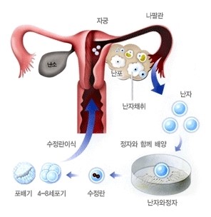 [시험관 아기 시술] 시험관 아기 시술 단계별로 진행과정을 알아봐요 : 네이버 블로그