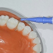 [아름드림 치과] 구강보조용품 치실,치간칫솔 사용법