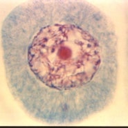 식물세포의 감수분열 관찰(사진)