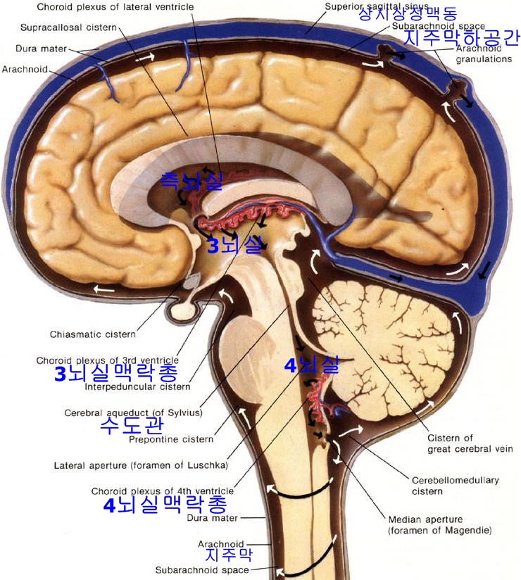 [뇌수종] 정상압 뇌수종, 교통성 뇌수종/비교통성 뇌수종. : 네이버 블로그