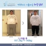 위밴드수술 12개월 후 57.2kg감량 전후사진