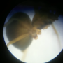 코접시거미(Anguliphantes nasus) 암외부생식기