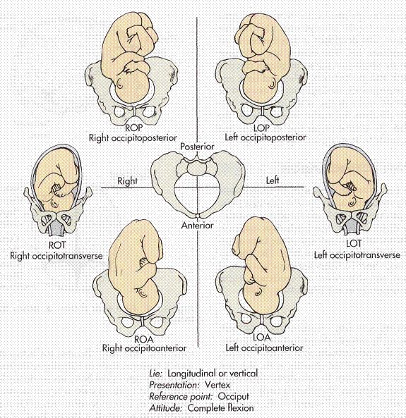 cephalic presentation roa