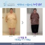 위밴드수술 12개월 후 74kg 감량 전후사진