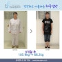 위밴드수술 9개월 후 37.7kg 감량 전후사진