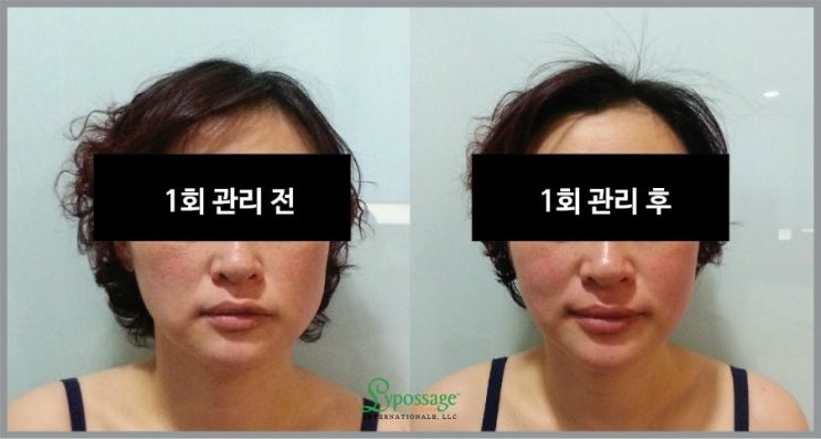 예뻐지는 V-라인 관리 받고나서, 제일 예뻐보여요^^ : 네이버 블로그