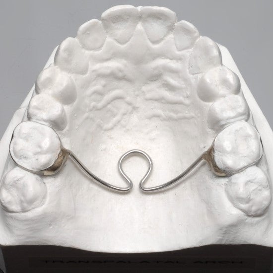 [치아교정 39주차] 상악 TPA 제거 네이버 블로그