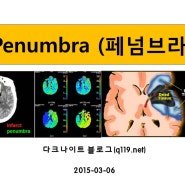 penumbra, 뇌졸중, 뇌경색, CBF,CBV, MTT, perfusion, penumbra zone, infarction, 뇌출혈