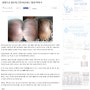 [강남역 평강한의원] 한방으로 탈모의 근원 치료하는 ‘평강 머리나’ - 크리스천투데이