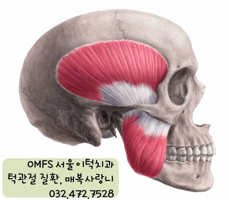 턱관절질환은 꼭 교정 치료 및 양악수술을 받아야 하나요? 무슨 과에 가야 하나요? : 네이버 블로그