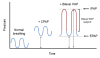 CPAP Bilevel Bipap   11 